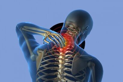 a nyaki gerinc poliszegmentális osteochondrosisa